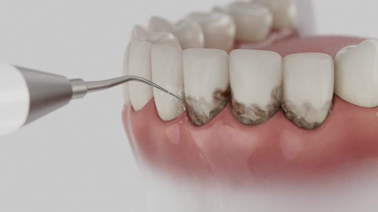 Reliable Dental contractor in Stanberry, MO by Smile Center Dentistry